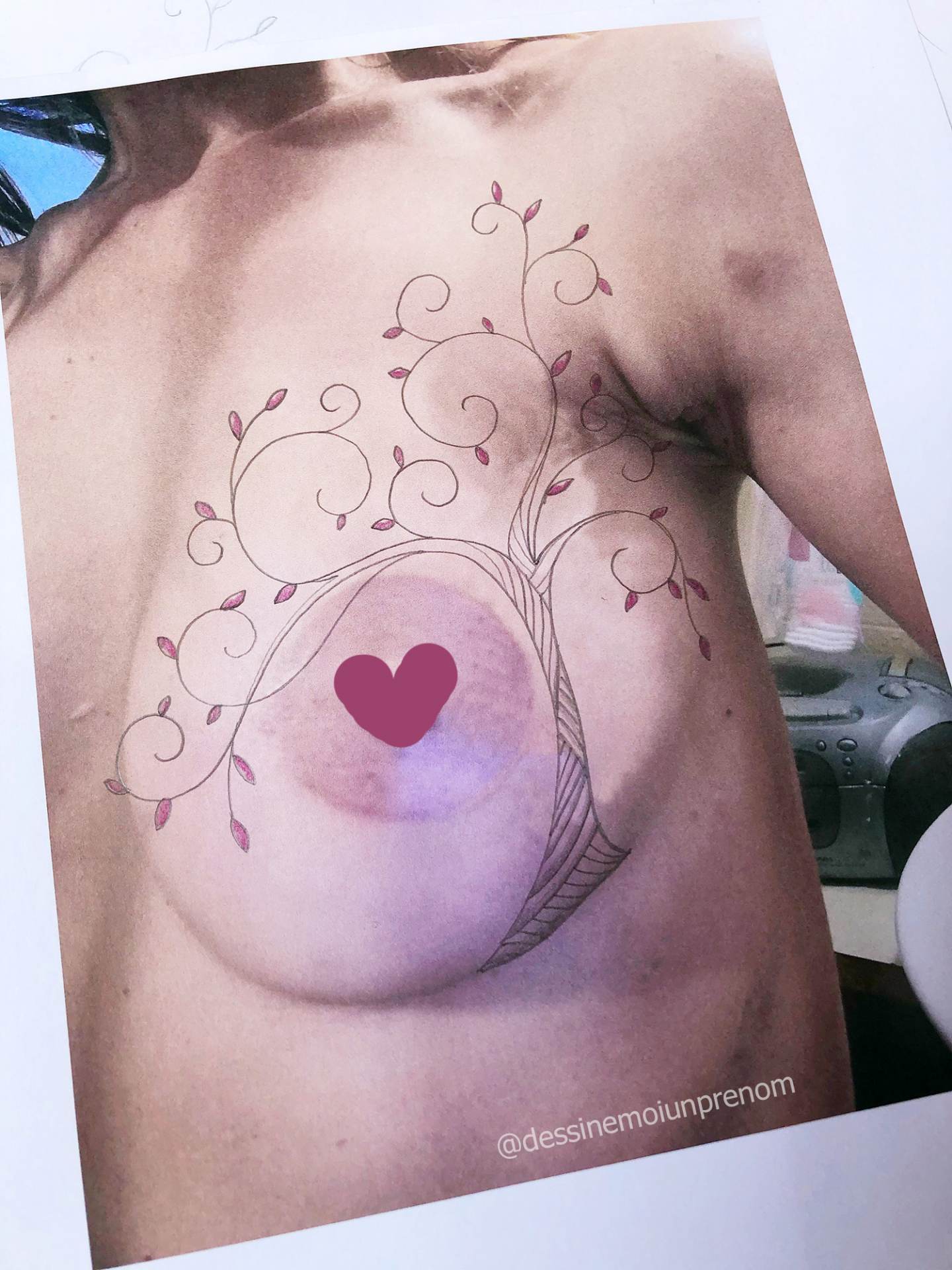 Dessin de tatouage après reconstruction mammaire arbre de vie