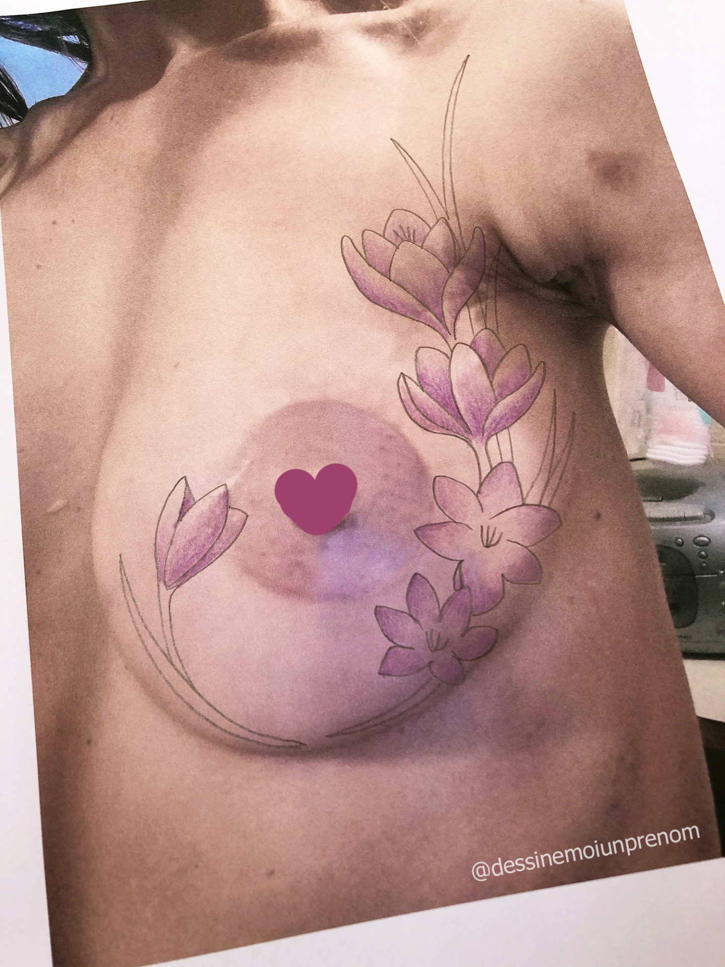 Dessin de tatouage après mastectomie et reconstruction mammaire